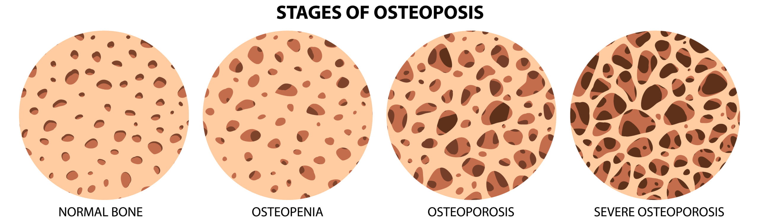 esquema horizontal osteo